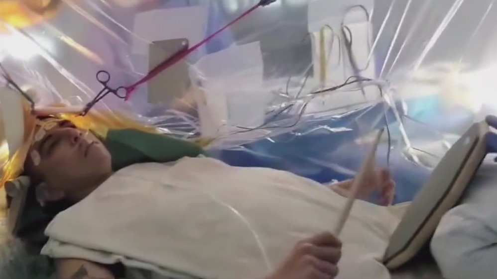 Houston patients play instruments during brain surgery
