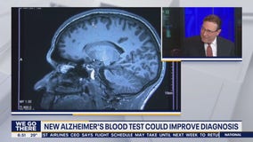 Health Watch: New Alzheimer's blood test could improve diagnosis