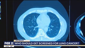 The Doctor Is In: Who should get screened for lung cancer?