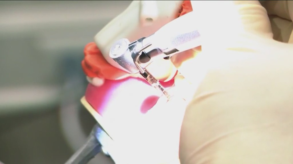 Dental surgeon introducing robotic system to assist in surgeries