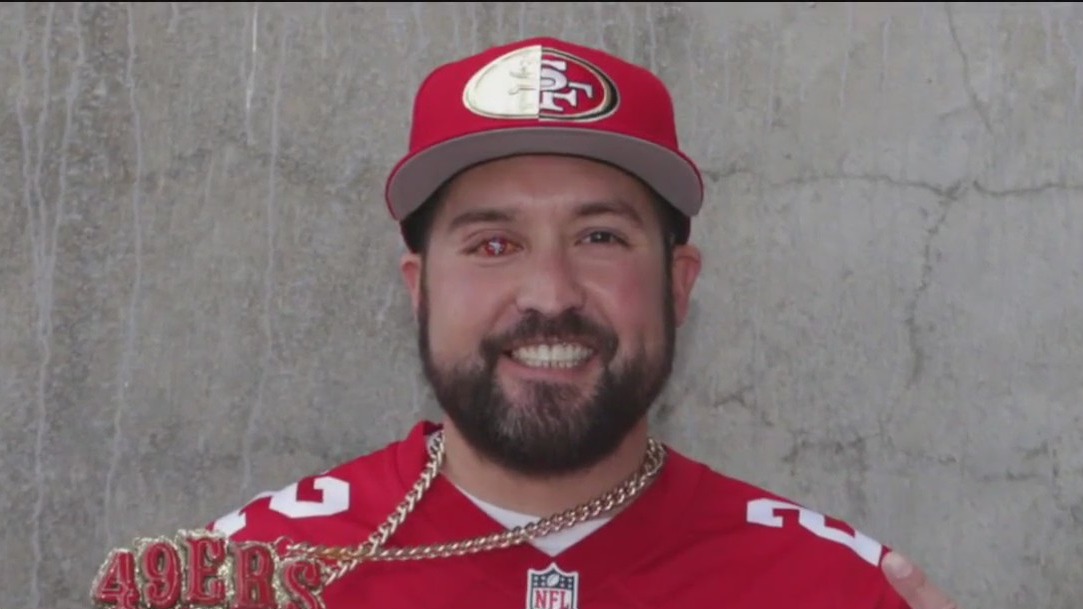 Eye of the Niner: Super fan has a 49er logo on his prosthetic eye