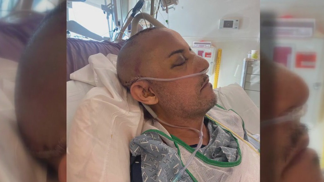 Man suffers head injury in West Hollywood