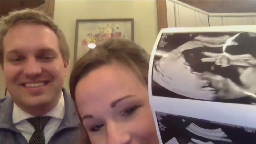 Couple's baby gives 'peace sign' during ultrasound