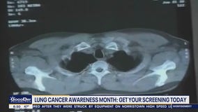 Lung Cancer Awareness Month: Get screened today!