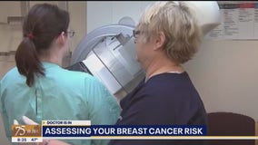 The Doctor Is In:  How to assess and lower your breast cancer risk