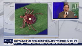 Health Watch: Tick bites raise risks of eating red meat