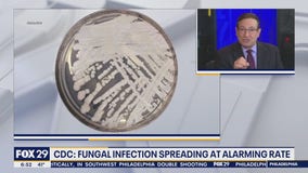 Health Watch: CDC warning of fungal infection spreading at 'alarming rate'