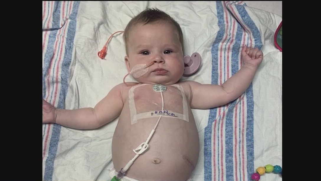 Infant girl's story of surviving cancer