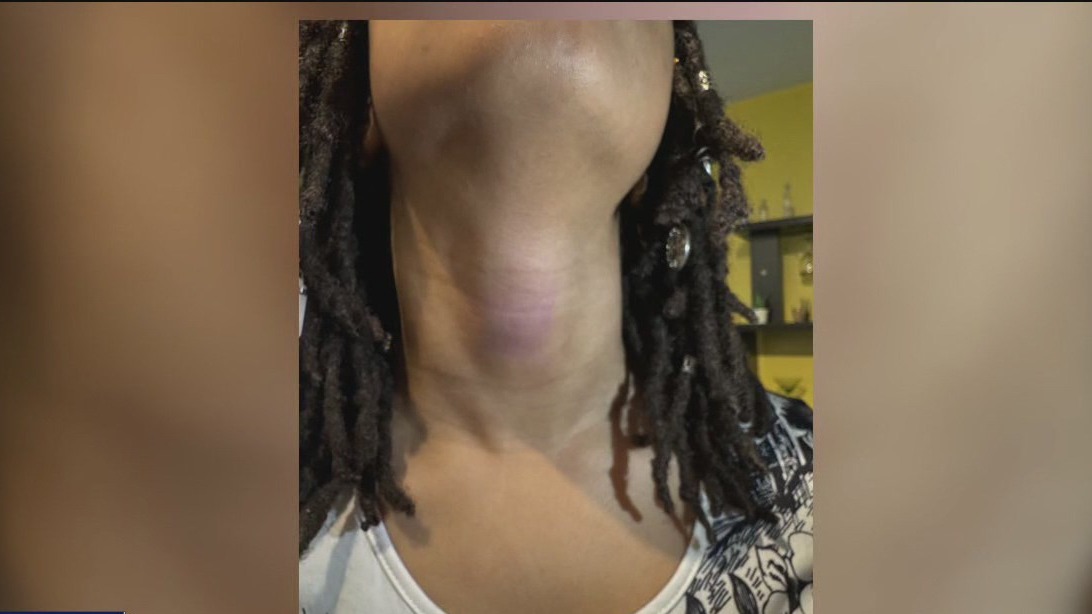 Racially charged bullying of student goes ignored by school officials, mom says