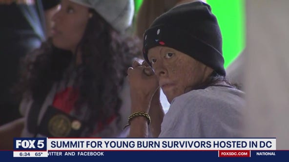 Teen burn survivors summit being held in DC