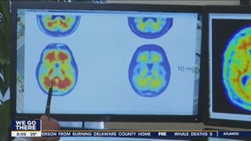 New hope for people living with Alzheimer’s