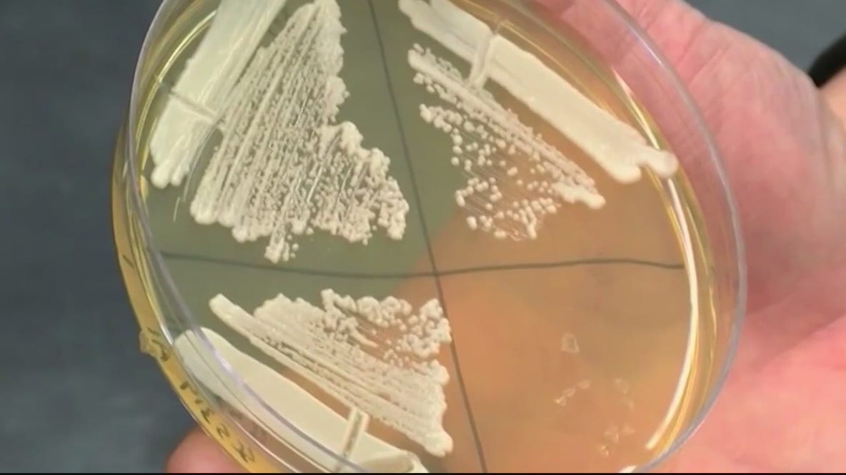 Growing concern over fungal infection Candida auris
