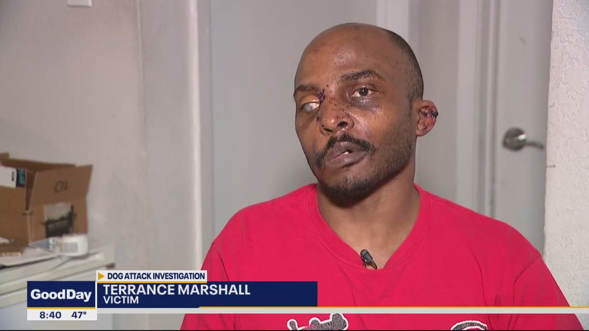 Arlington man recovering after pit bull attack