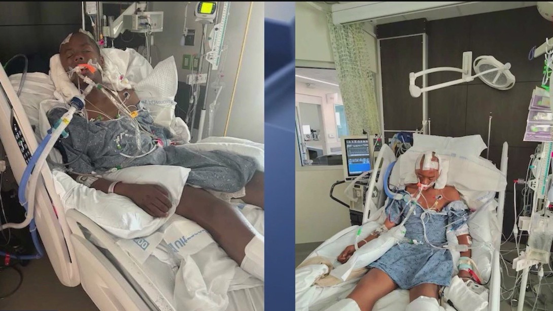 Teen recovering after pool party shooting