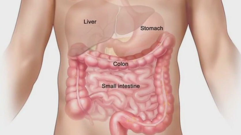 Increase in colorectal cancer diagnoses in people under 50