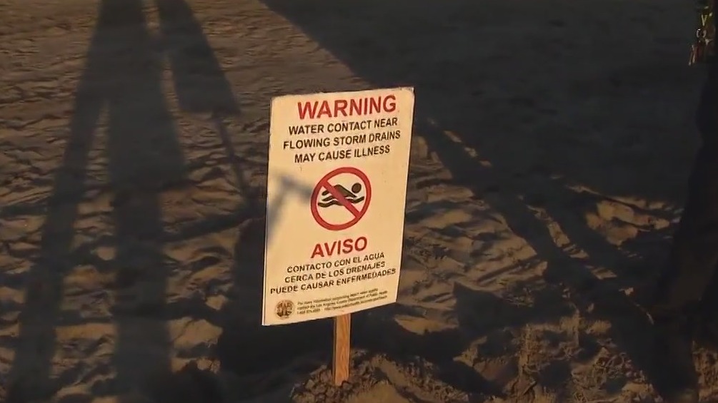 SoCal officials warn Angelenos to avoid beach ahead of winter storms