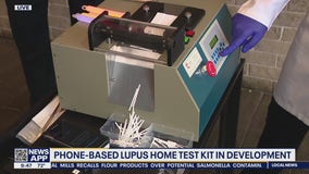 UH team developing lupus home test