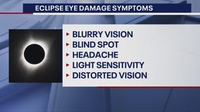 How to tell if you've caused eye damage looking at the eclipse
