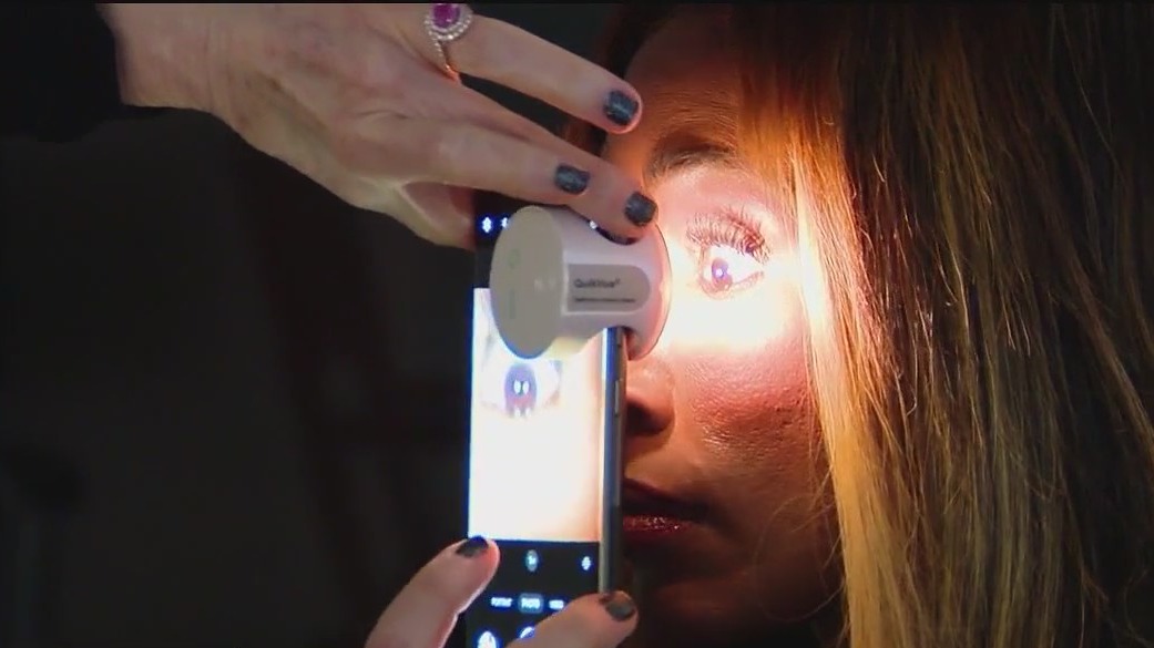 Iridology: Using alternative medicine to unlock genetic clues through the eye