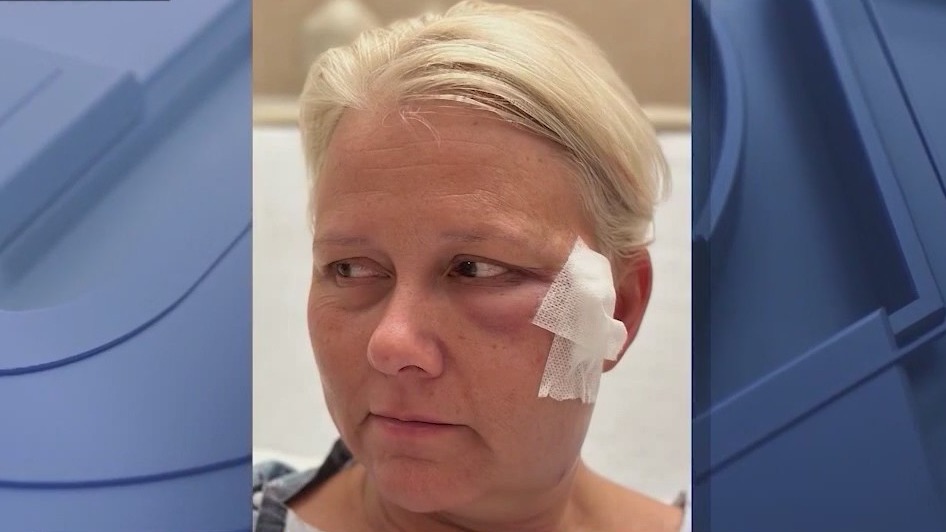 Nearly 1 year since woman was hit by stray NYE bullet