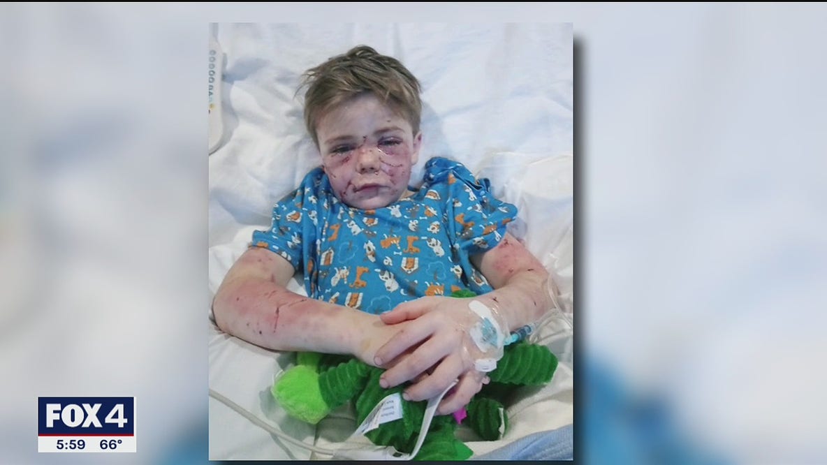 Azle 7-year-old nearly mauled to death by neighbor's dog