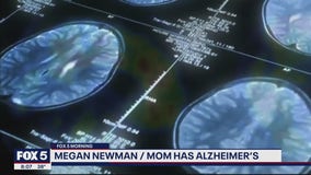 New drug gives renewed hope to Alzheimer's patients