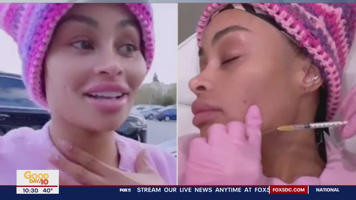 Blac Chyna gets filler removed