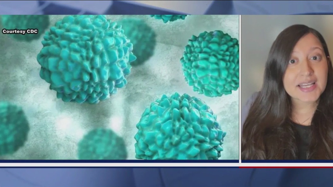 Norovirus cases spike in the Northeast