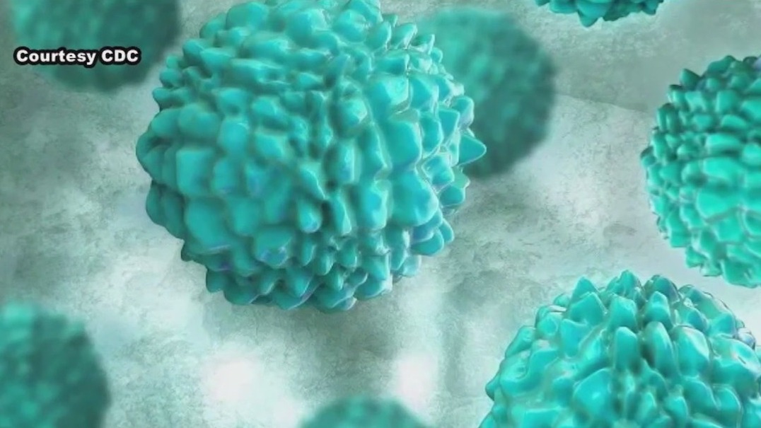 CDC warns of spreading norovirus