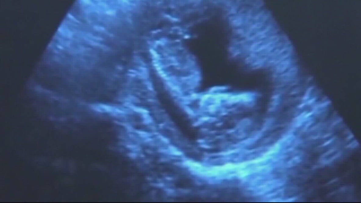 Abortion battle coming in Michigan