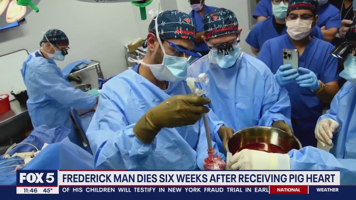 Frederick man dies six weeks after receiving pig heart transplant
