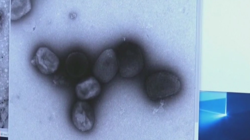 NYC opens new monkeypox vaccine clinic in Harlem