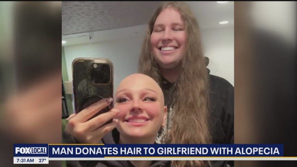 Local man donates hair to girlfriend with alopecia
