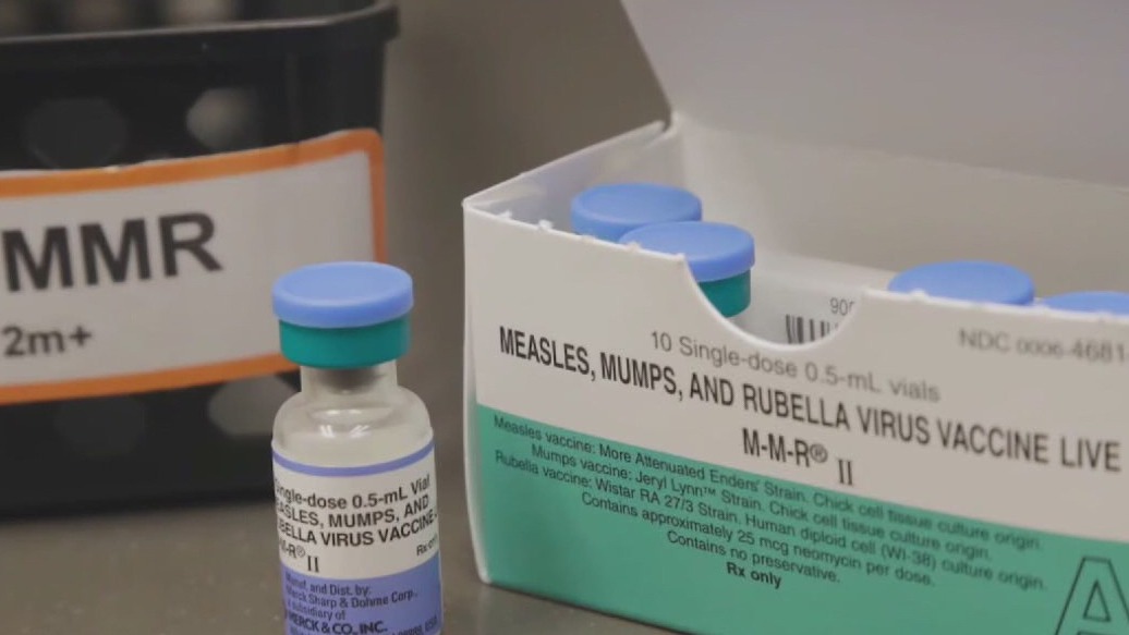 Concerns over possible measles outbreak in MN