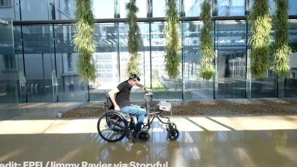 Paralyzed man walks again with thought-controlled brain, spine implants