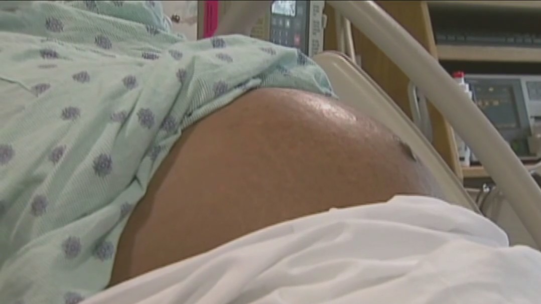 U.S. women giving birth now 3 times as likely have syphilis