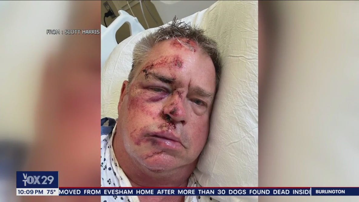 Retired Navy officer gets over 100 stitches after being mugged while walking dog in Philadelphia