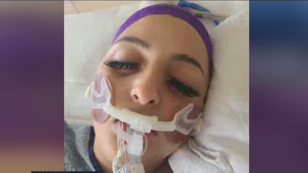 Woman shot by school resource officer on life support, family says