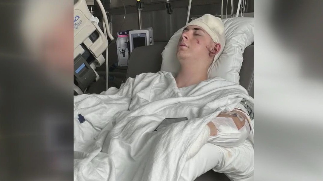 Machete attack victim speaks out FOX 7 Austin