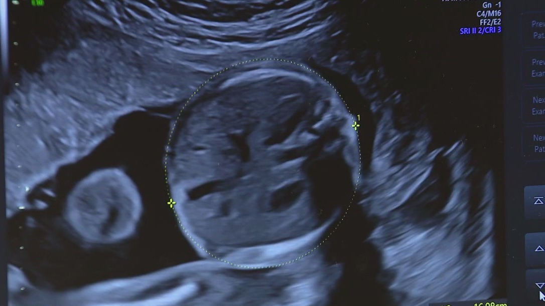 OB-GYN residency program launches at AdventHealth Tampa | FOX 13 Tampa Bay