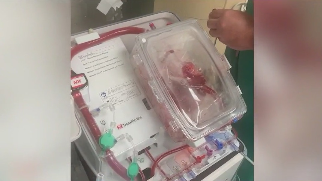 'Heart in a Box' increases viability for donated organs