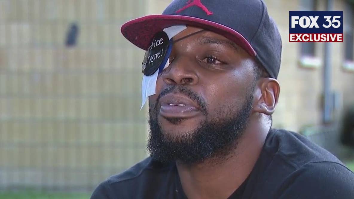 Florida man missing eye after K9 attack, police say