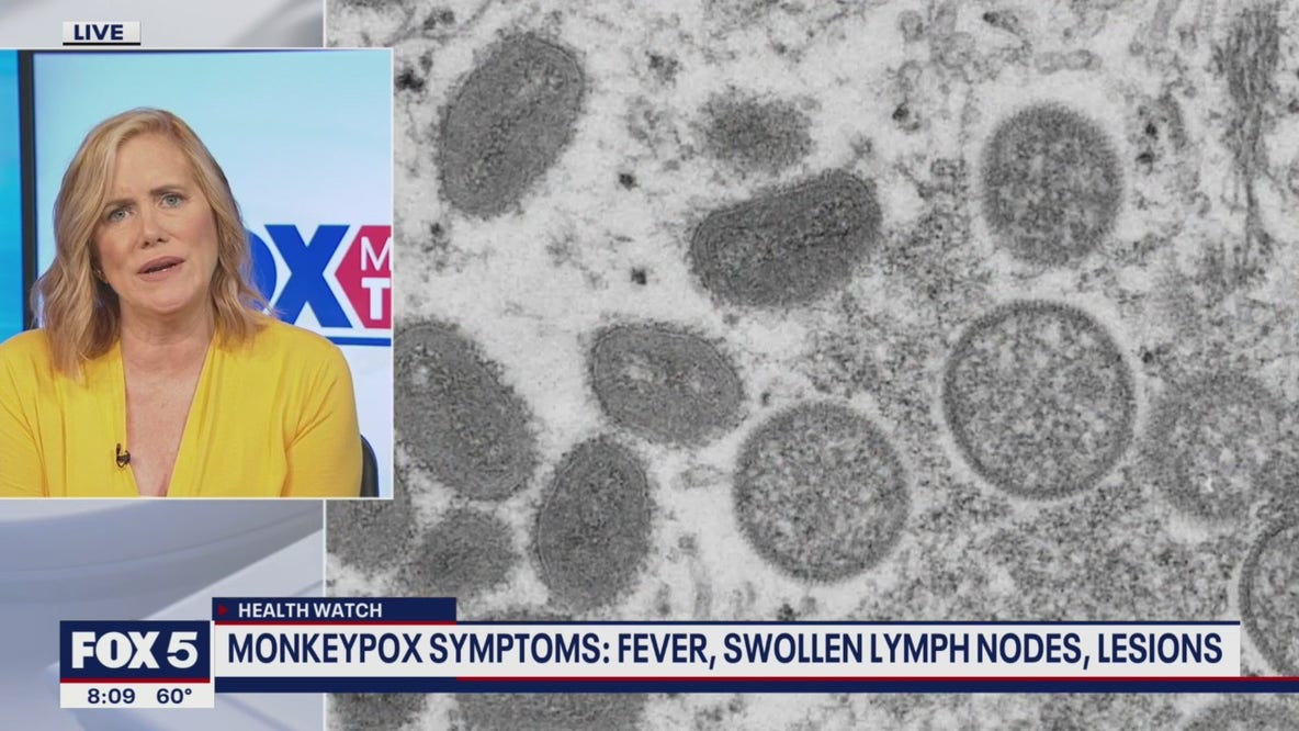 Monkeypox: What are the symptoms and should we be concerned?