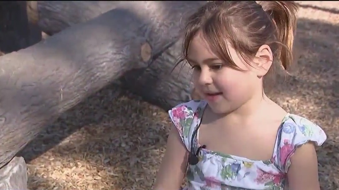 Florida girl recovering from third-degree burns