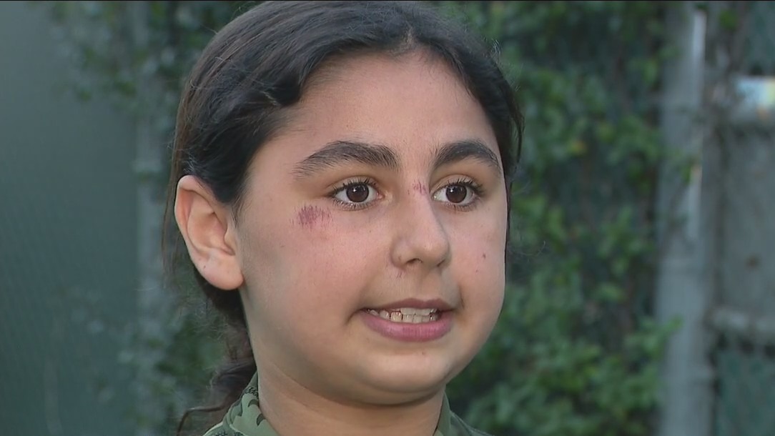 Parent speaks out after daughter collapses on soccer field while playing with face mask on