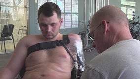 Ukrainian war veterans receive free prosthetics in Minnesota