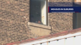 Chicago measles cases surpass 50