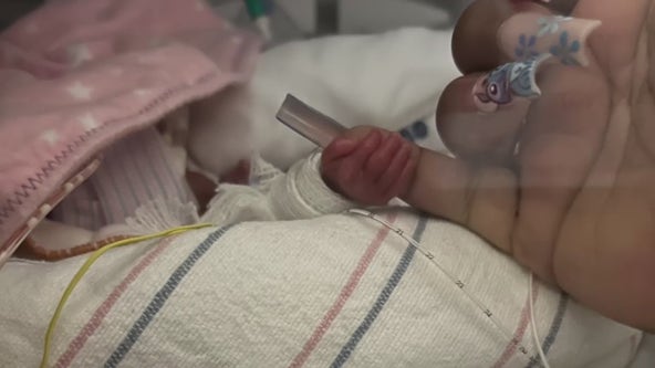 'Miracle' preemie gets to go home