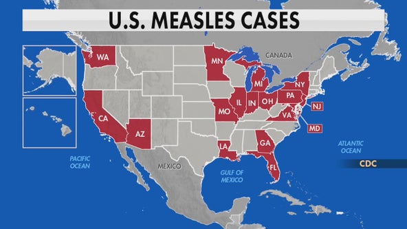 Measles cases decline in Illinois, but surge seen across multiple states