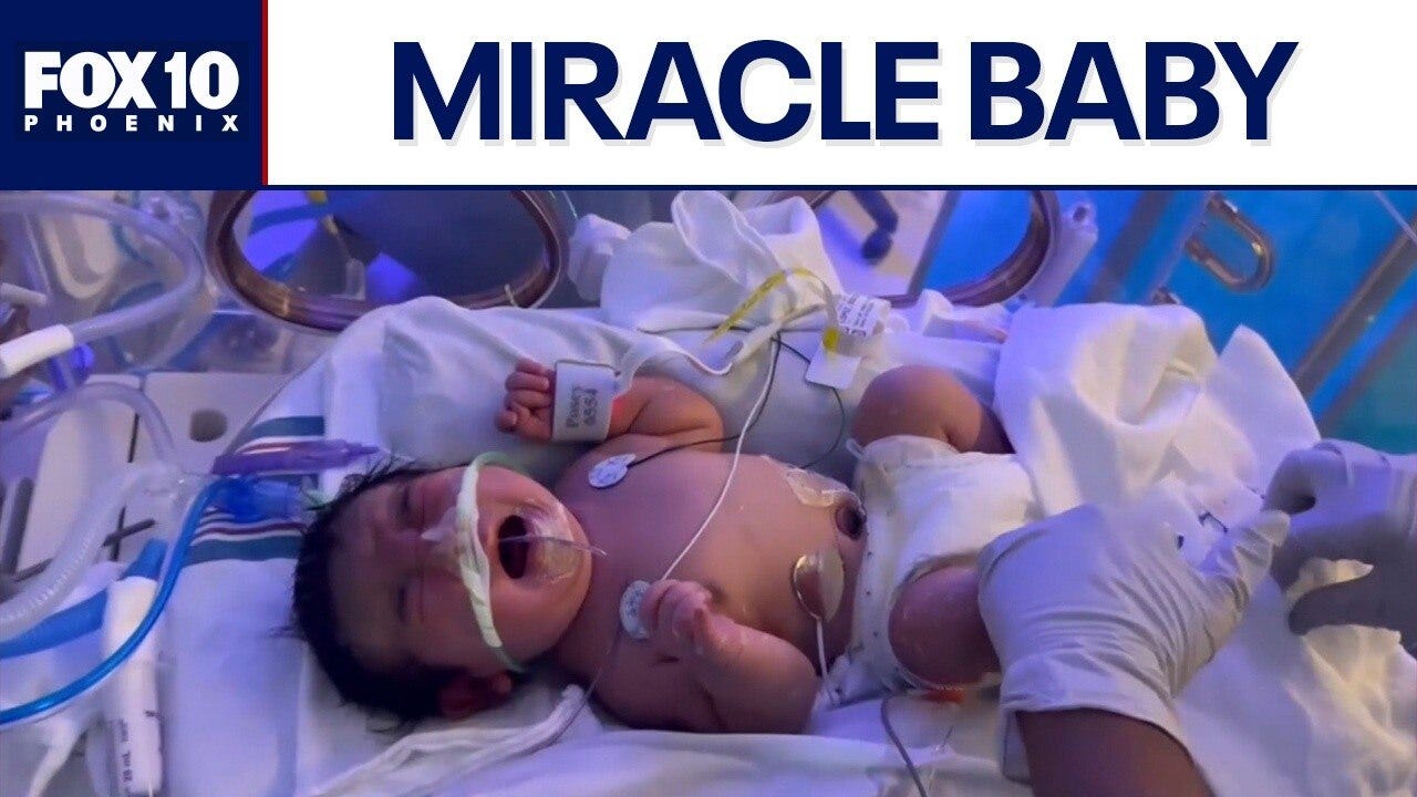 Baby born after rarest of pregnancies, defying all odds 